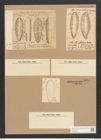 Surirella dentata Schum. (de-Toni-Nr.: Genus 53, Species 2248) Zeichnungen Sammlung Grunow Nr. 4681 (NHMW-BOT-W0372754)